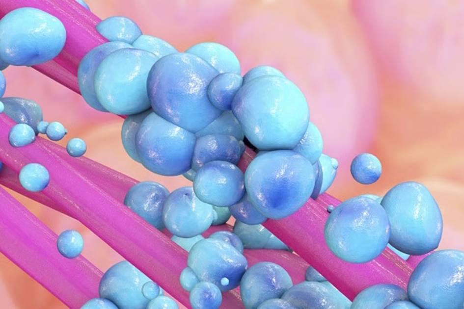 Photo: independentarabia.com Gut Bacteria Linked to Colorectal Cancer Risk