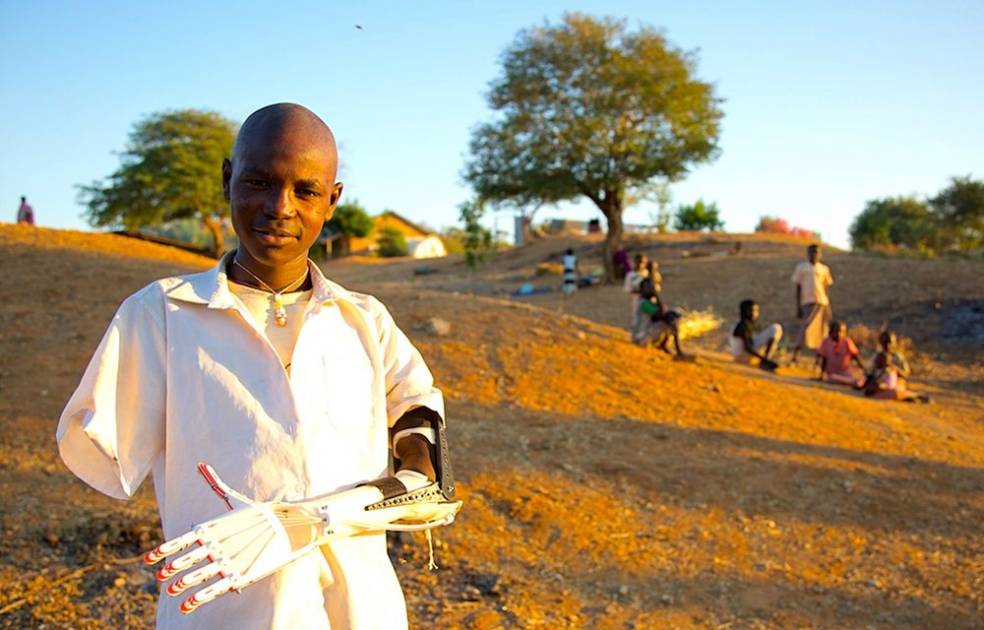 مصابو حرب السودان: أطراف مبتورة وآمال لا تنقطع