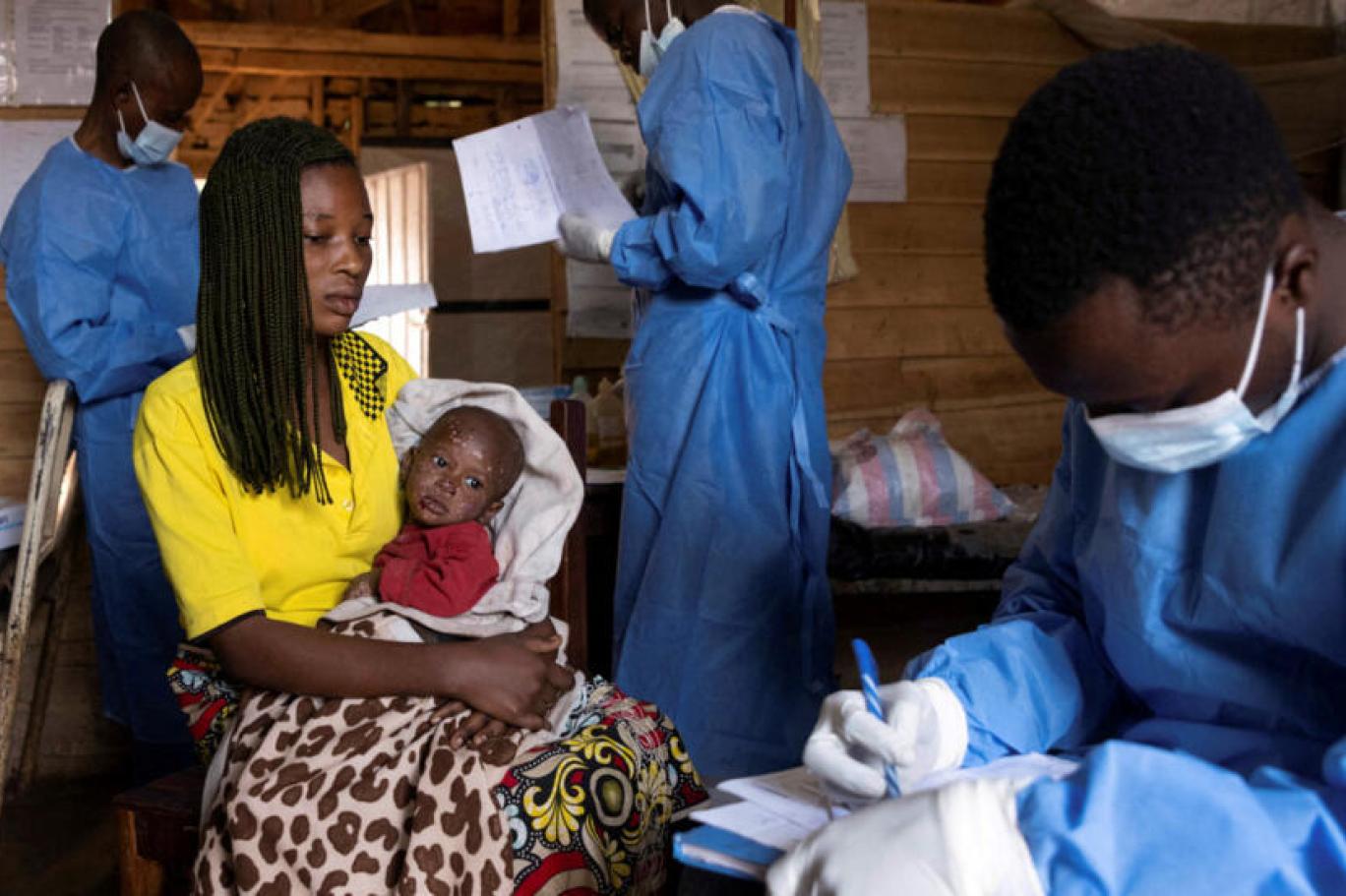 مرض غامض في الكونغو الديمقراطية و"الصحة العالمية" ترسل خبراء | اندبندنت عربية