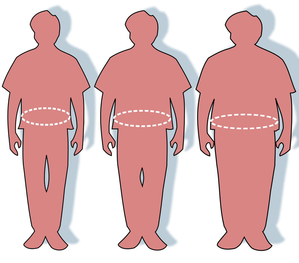 البدانة ليست قدراً على الرغم من معطياتها المنحوتة في الجينات 