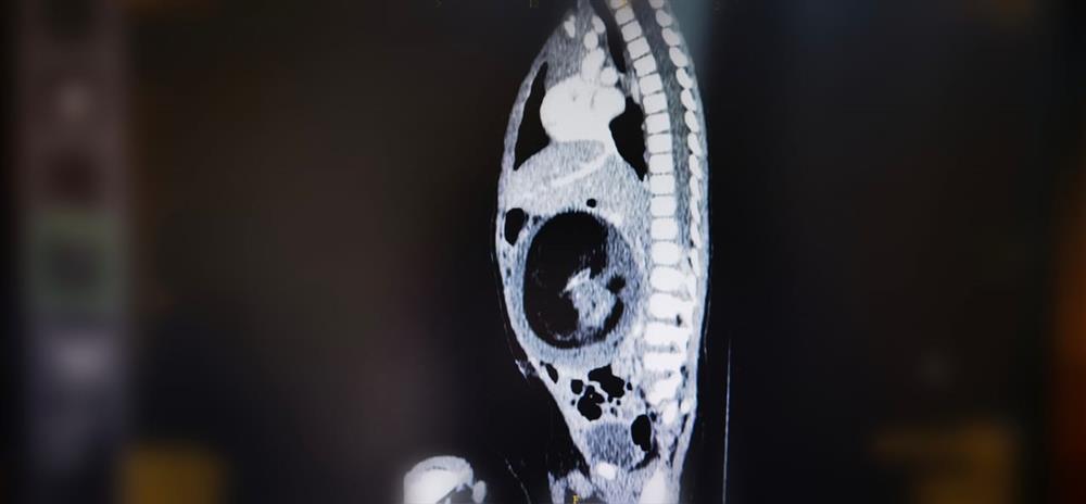 صورة مقطعية للحالة الطبيعة النادرة (وكالة الأنباء العمانية)