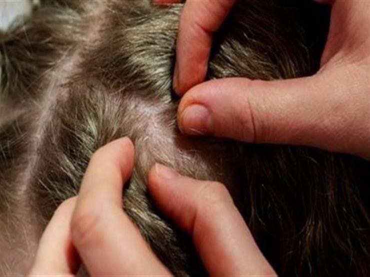 ظاهرة صحية بين الأطفال تثير الفزع في تونس