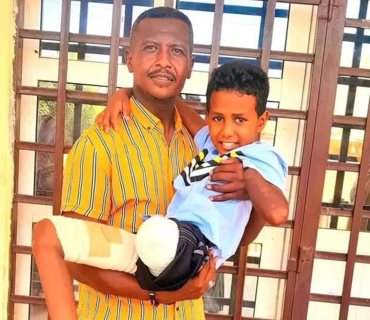 الأطفال مبتورو الأطراف ضحايا قذائف حرب السودان الأطفال مبتورو الأطراف ضحايا قذائف حرب السودان