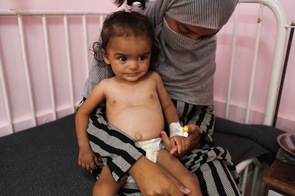 الفلسطينية زينة رضوان تحمل ابنتها ماريا البالغة من العمر 10 أشهر، والتي تعاني من سوء التغذية في مستشفى ناصر في خان يونس، 24 يوليو 2025 (رويترز).JPG