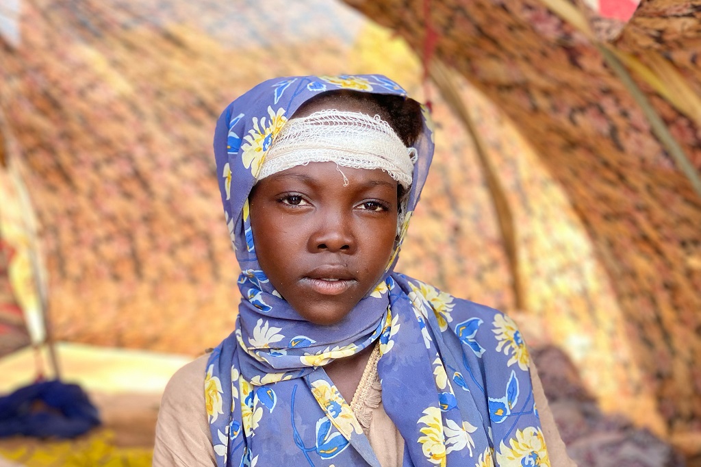 خواطر محمد، سودانية مصابة فرّ من مدينة الفاشر تتلقى الرعاية الطبية في مخيم في طويلة، 30 أكتوبر 2025 (أ ف ب).jpg