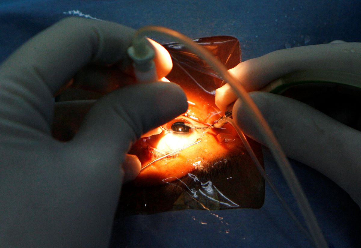  التبرع بالجلد يعيد جدل زراعة الأعضاء في مصر