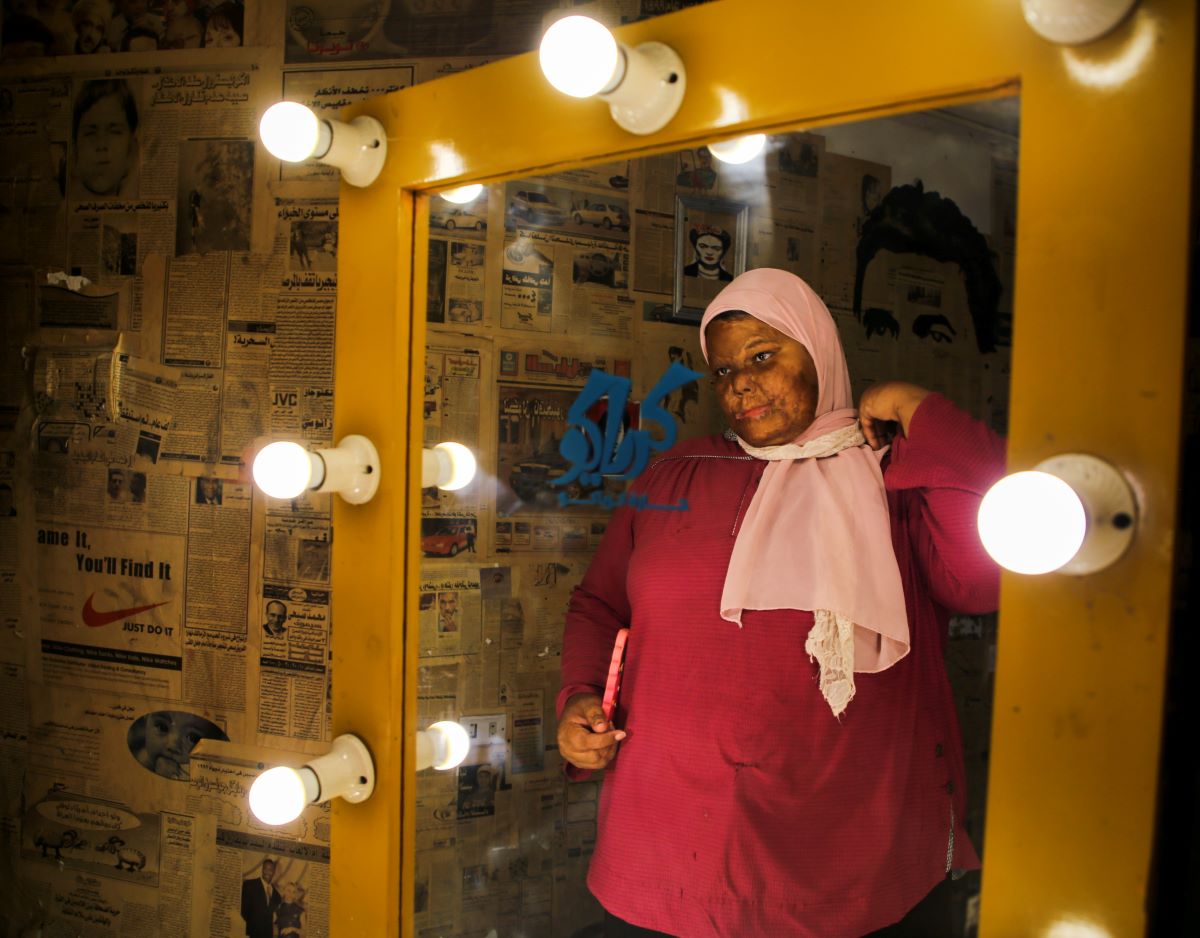  التبرع بالجلد يعيد جدل زراعة الأعضاء في مصر