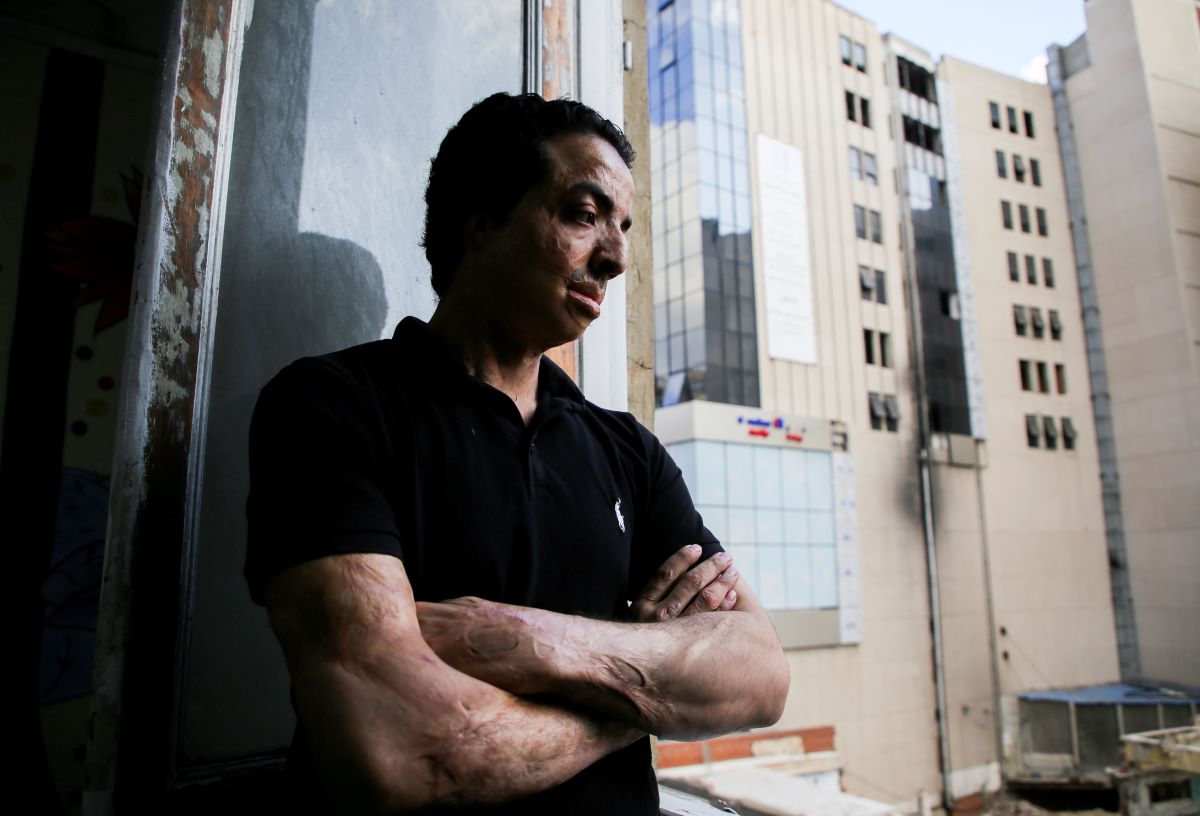  التبرع بالجلد يعيد جدل زراعة الأعضاء في مصر