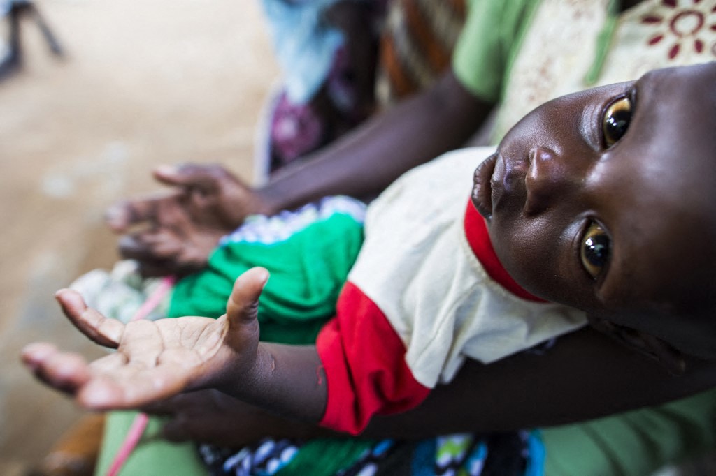 AFP__20151011__Par8297802__v1__MidRes__SsudanUnrestHealthMalnutrition (1).jpg